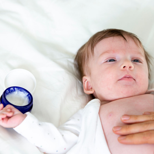 Aplicación de crema hidratante a un bebé
